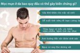 Bao quy đầu nổi mụn thịt có phải dấu hiệu bệnh tình dục?