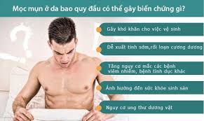 Bao quy đầu nổi mụn thịt có phải dấu hiệu bệnh tình dục?