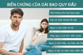 DÀI BAO QUY ĐẦU LÀ GÌ? NGUYÊN NHÂN KHIẾN BAO QUY ĐẦU BỊ DÀI