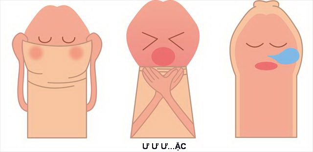 Hẹp bao quy đầu phải làm sao?