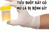 Tiểu ra mủ – cảnh báo 5 căn bệnh khôn lường!